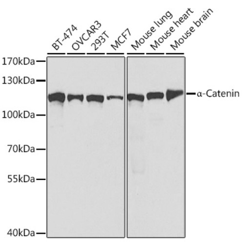 [KO Validated] α-Catenin Rabbit pAb