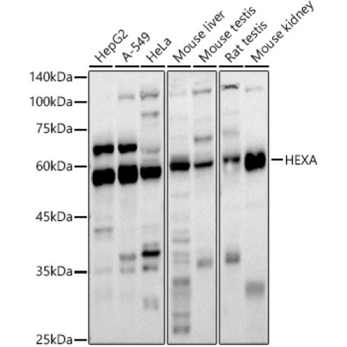 HEXA Rabbit pAb