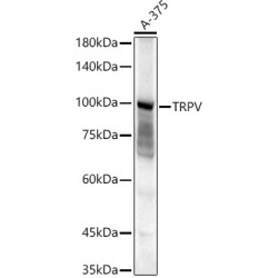 TRPV4 Rabbit pAb