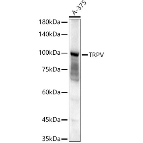 TRPV4 Rabbit pAb