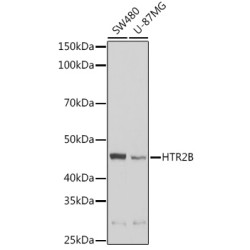 HTR2B Rabbit pAb