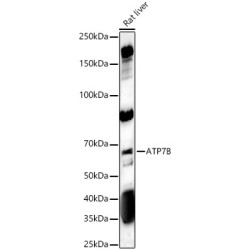 ATP7B Rabbit pAb