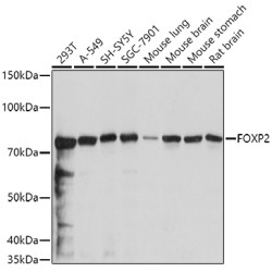 FOXP2 Rabbit pAb