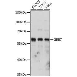 GRB7 Rabbit pAb
