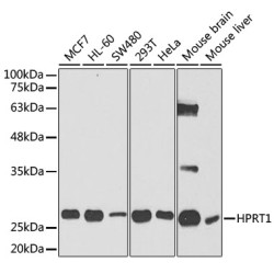 [KO Validated] HPRT1 Rabbit pAb
