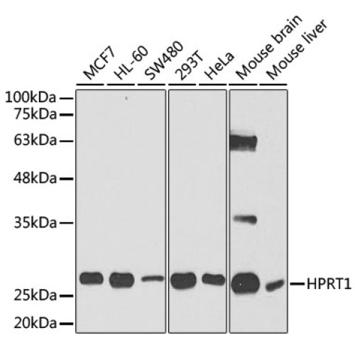 [KO Validated] HPRT1 Rabbit pAb