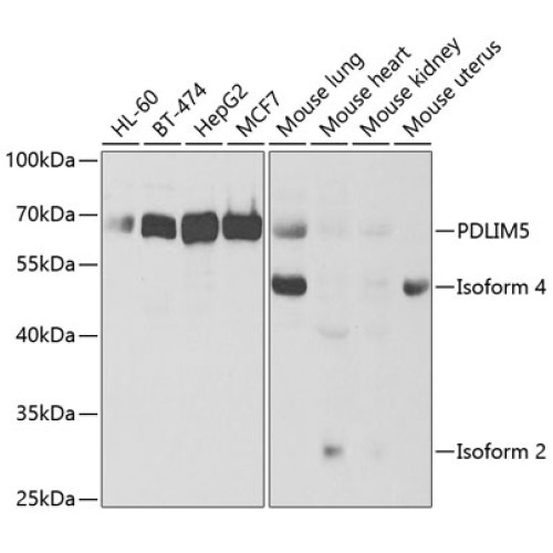 PDLIM5 Rabbit pAb