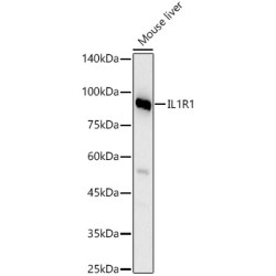 IL1R1 Rabbit pAb