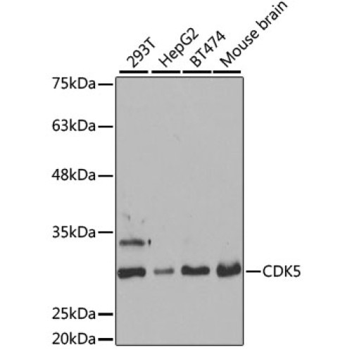 [KO Validated] CDK5 Rabbit pAb