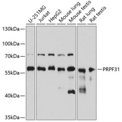 PRPF31 Rabbit pAb