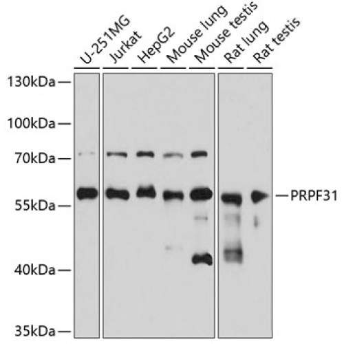 PRPF31 Rabbit pAb