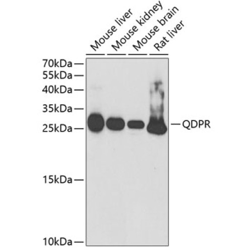 QDPR Rabbit pAb