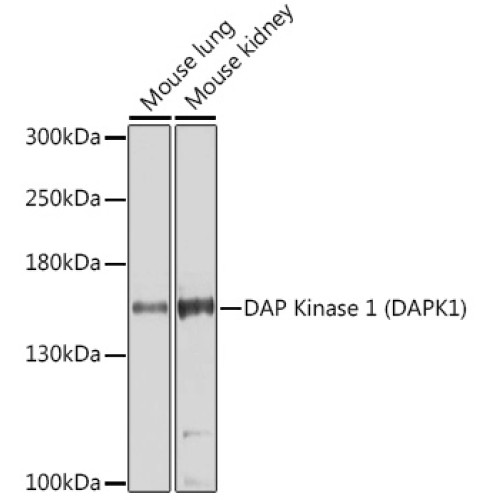 DAP Kinase 1 (DAPK1) Rabbit pAb