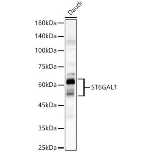 ST6GAL1 Rabbit pAb