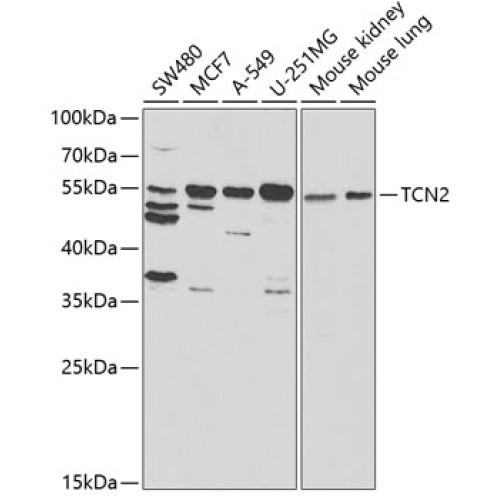 TCN2 Rabbit pAb