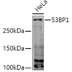 53BP1 Rabbit pAb