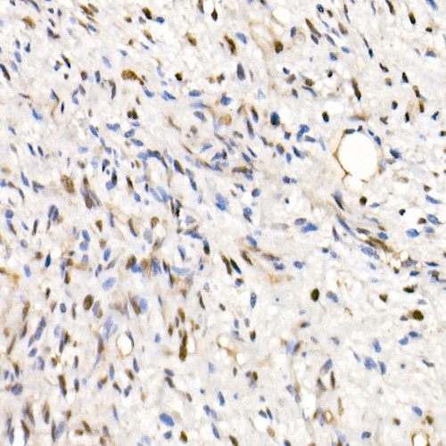 SMARCB1/SNF5 Rabbit pAb