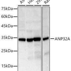 ANP32A Rabbit pAb