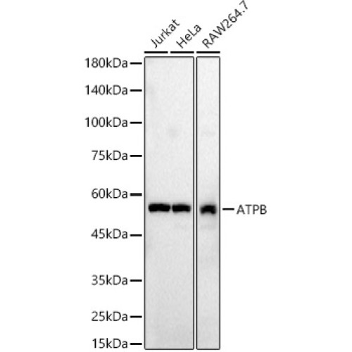 ATPB Rabbit pAb