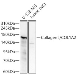Collagen I/COL1A2 Rabbit pAb