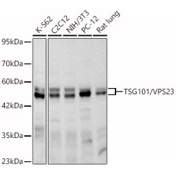 TSG101/VPS23 Rabbit mAb