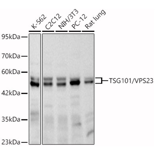 TSG101/VPS23 Rabbit mAb