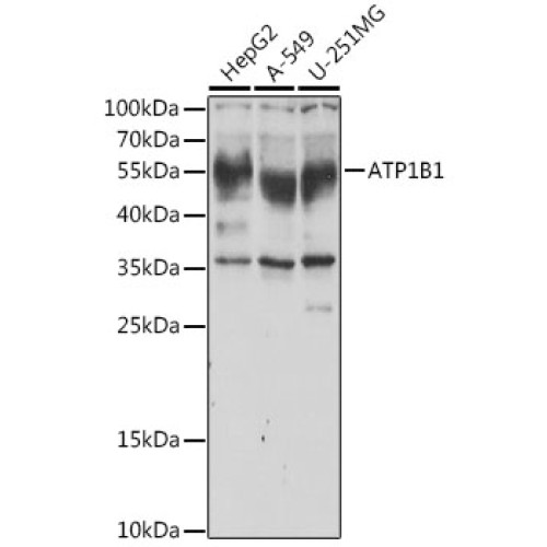 ATP1B1 Rabbit pAb