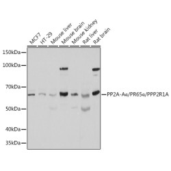 PP2A-Aα/PR65α/PPP2R1A Rabbit pAb