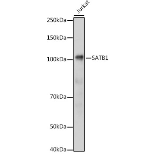 SATB1 Rabbit pAb