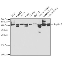 Septin 2 Rabbit pAb