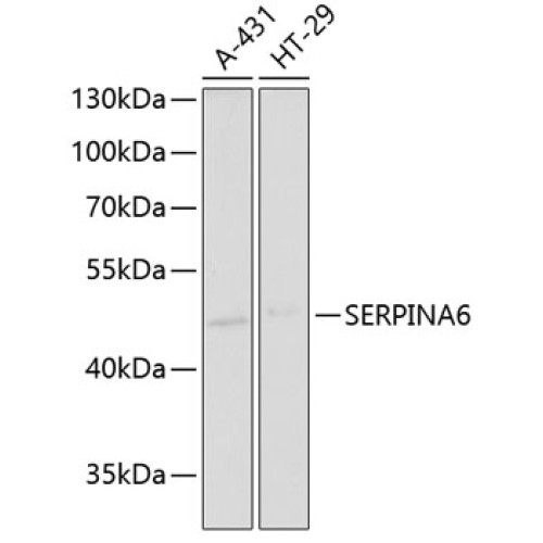 SERPINA6 Rabbit pAb