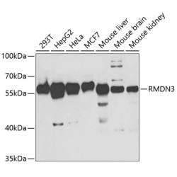 PTPIP51/RMDN3 Rabbit pAb