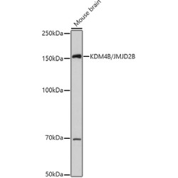 KDM4B/JMJD2B Rabbit pAb