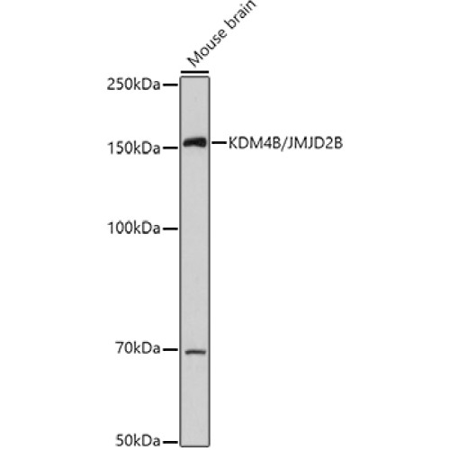 KDM4B/JMJD2B Rabbit pAb