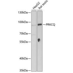 PRKCQ Rabbit pAb