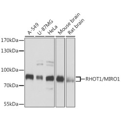 [KD Validated] RHOT1/MIRO1 Rabbit pAb