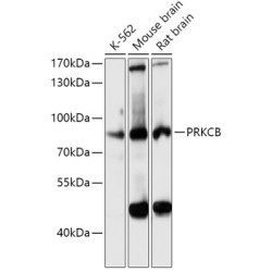 PKC-beta Rabbit pAb