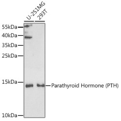 Parathyroid Hormone (PTH) Rabbit pAb