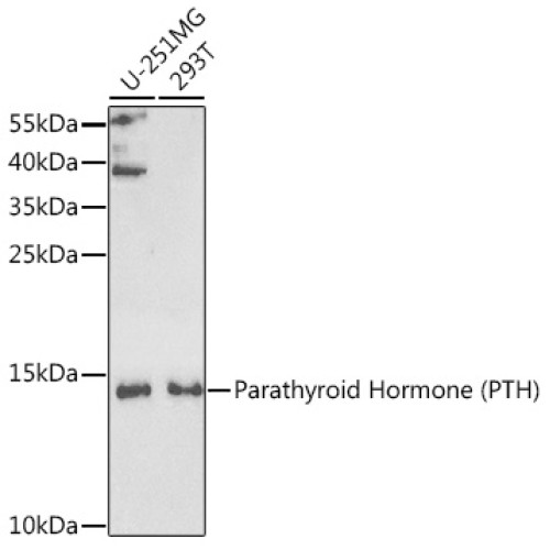 Parathyroid Hormone (PTH) Rabbit pAb