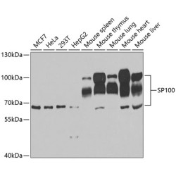 SP100 Rabbit pAb