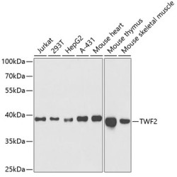 TWF2 Rabbit pAb