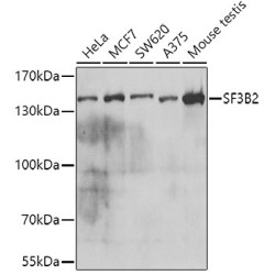 SF3B2 Rabbit pAb
