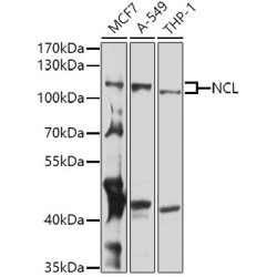 NCL Rabbit pAb