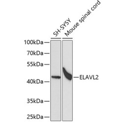 ELAVL2 Rabbit pAb