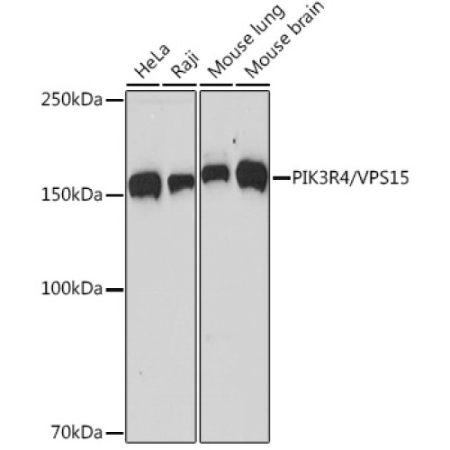 PIK3R4/VPS15 Rabbit mAb