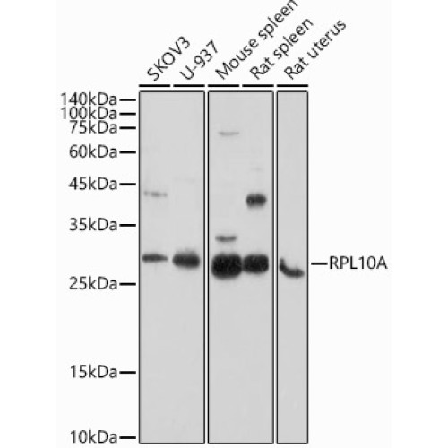 RPL10A Rabbit pAb