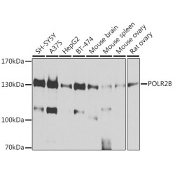 POLR2B Rabbit pAb