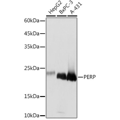 PERP Rabbit mAb