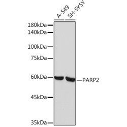 PARP2 Rabbit mAb