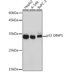 p53 DINP1 Rabbit mAb